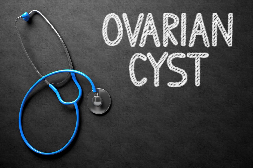 Chalkboard With Ovarian Cyst Concept. 3d Illustration.